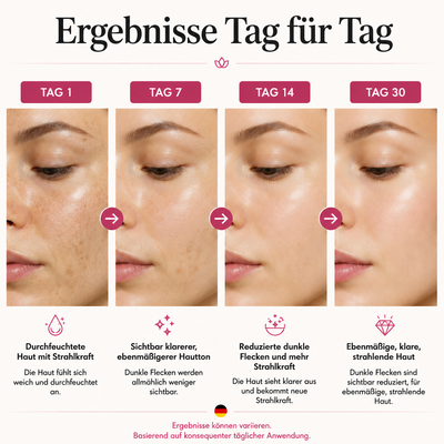 Niacinamide 10% + TXA 4% Dark Spot Correcting Serum