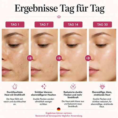 Niacinamide 10% + TXA 4% Dark Spot Correcting Serum