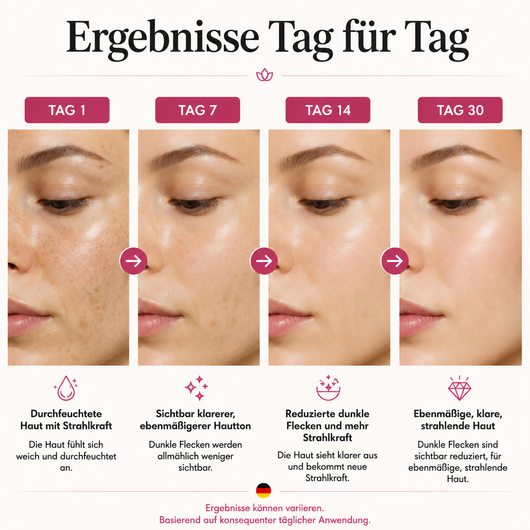 Niacinamide 10% + TXA 4% Dark Spot Correcting Serum