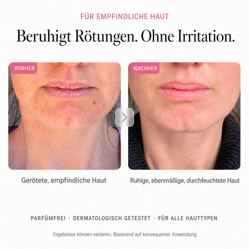 Arbutin 7% Brightening Cream