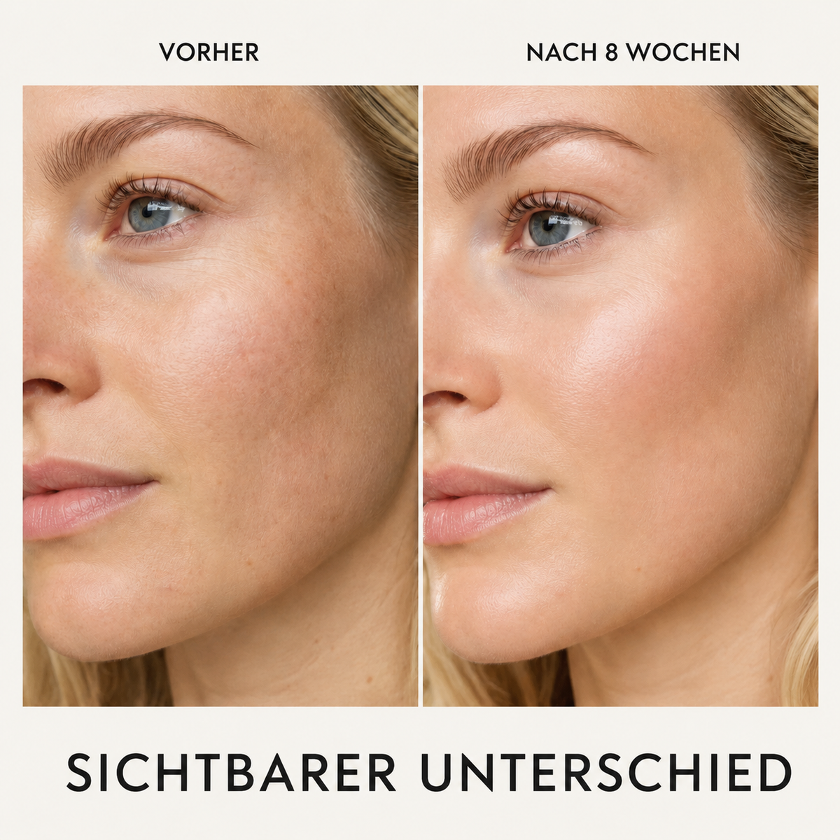 Vorher und nachher, acht Wochen Anwendung